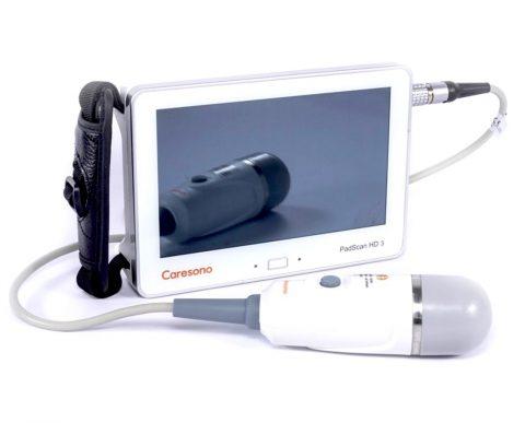 Caresono HD3 Bladder Scanner